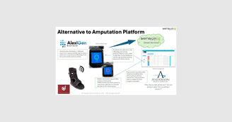 banner image for: AlexiGen, Sensoria, Defender and Anderson Announce Strategic Partnership to Create an Alternative to Amputation Diabetic Foot Ulcer Platform